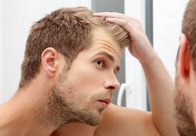 The Other Places You Never Thought Dandruff Could Reach