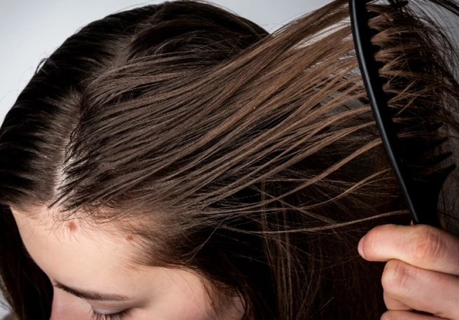 Oily Scalp: Why you have it and how to prevent it